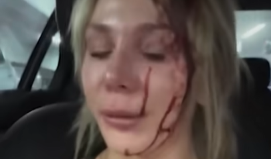Slika članka