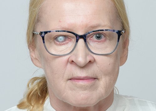 Slika članka