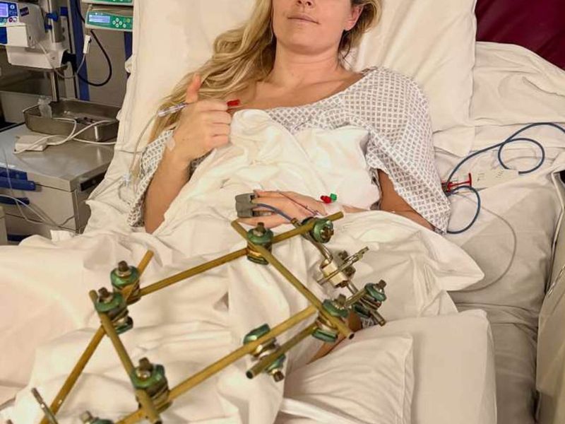 Slika članka
