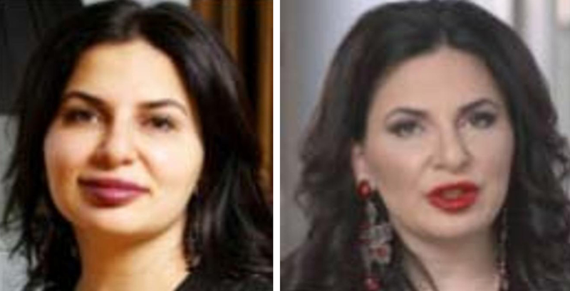 Slika članka